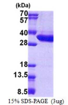 SDS-PAGE: Recombinant Human MLEC His Protein [NBP2-23213]