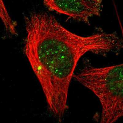 Immunocytochemistry/ Immunofluorescence: MLF1 Interacting Protein Antibody [NBP1-85689]