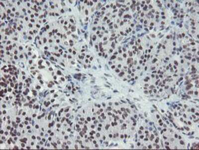 Immunohistochemistry-Paraffin: MLF2 Antibody (OTI1E3) [NBP2-03726]
