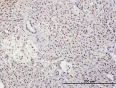 Immunohistochemistry-Paraffin: MLF2 Antibody (2F6-1E3) [H00008079-M01]