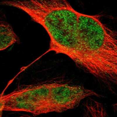 Immunocytochemistry/ Immunofluorescence: MLF2 Antibody [NBP1-82518]