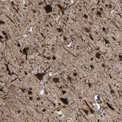 Immunohistochemistry-Paraffin: MLF2 Antibody [NBP1-82518]