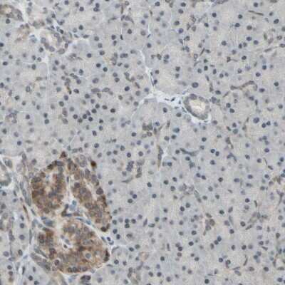 Immunohistochemistry-Paraffin: MLF2 Antibody [NBP1-82518]