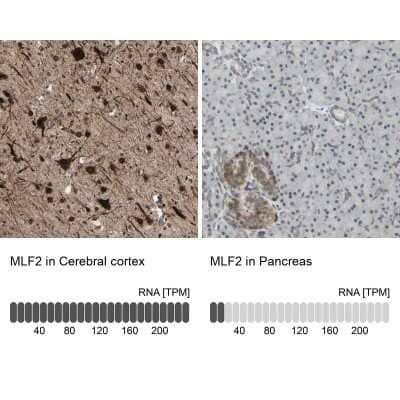 Immunohistochemistry-Paraffin: MLF2 Antibody [NBP1-82518]