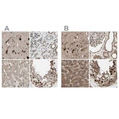 Immunohistochemistry-Paraffin: MLF2 Antibody [NBP1-82518]