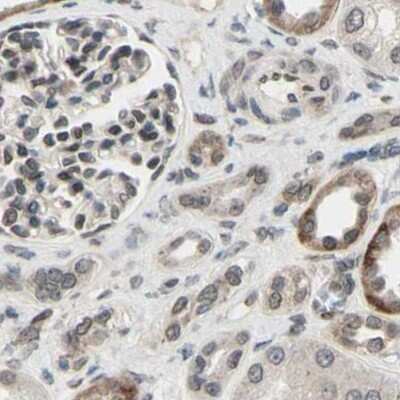 Immunohistochemistry-Paraffin: MLF2 Antibody [NBP1-82518]