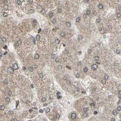 Immunohistochemistry-Paraffin: MLF2 Antibody [NBP1-82518]