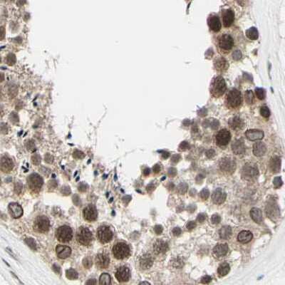 Immunohistochemistry-Paraffin: MLF2 Antibody [NBP1-82518]