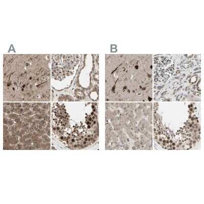 Immunohistochemistry-Paraffin: MLF2 Antibody [NBP1-82519]