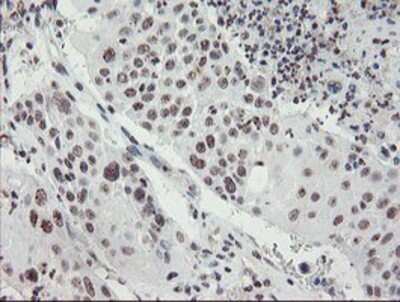 Immunohistochemistry: MLF2 Antibody (OTI1E3) - Azide and BSA Free [NBP2-72721]