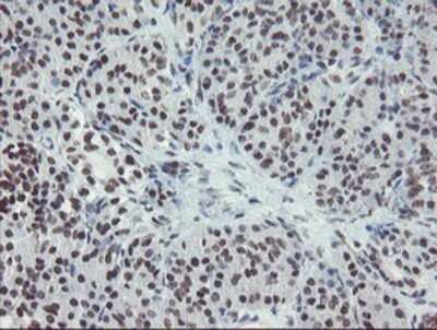 Immunohistochemistry: MLF2 Antibody (OTI1E3) - Azide and BSA Free [NBP2-72721]