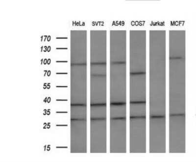 Western Blot: MLF2 Antibody (OTI1E3)Azide and BSA Free [NBP2-72721]