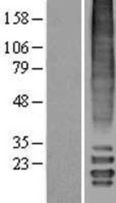 Western Blot: MLF2 Overexpression Lysate [NBL1-13133]