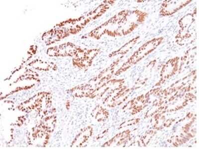 Immunohistochemistry-Paraffin: MLH1 Antibody (G168-728) - Azide and BSA Free [NBP3-08602]