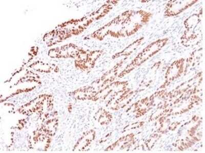 Immunohistochemistry-Paraffin: MLH1 Antibody (G168-728) [NBP3-07320]