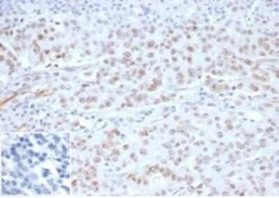Immunohistochemistry-Paraffin: MLH1 Antibody (MLH1/6284R) [NBP3-13971]