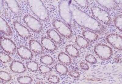 Immunohistochemistry-Paraffin: MLH1 Antibody (MLH1/6284R) [NBP3-13971]