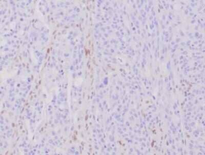 Immunohistochemistry-Paraffin: MLH1 Antibody (MLH1/6284R) [NBP3-13971]