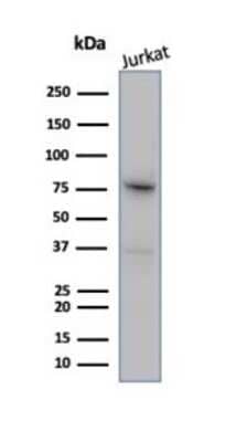 Western Blot: MLH1 Antibody (MLH1/6284R) [NBP3-13971]