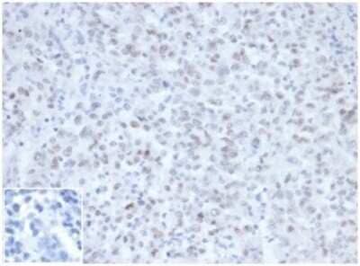 Immunohistochemistry-Paraffin: MLH1 Antibody (MLH1/6467) [NBP3-13969]