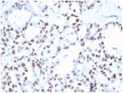 Immunohistochemistry-Paraffin: MLH1 Antibody (MLH1/6467) [NBP3-13969]