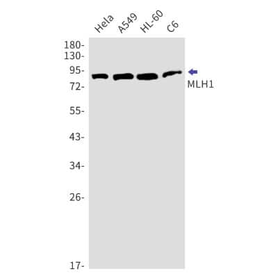 Western Blot: MLH1 Antibody (S07-5D3) [NBP3-14898]