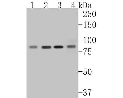 Western Blot: MLH1 Antibody (SP08-04) [NBP2-67381]