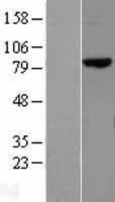 Western Blot: MLH1 Overexpression Lysate [NBL1-13134]