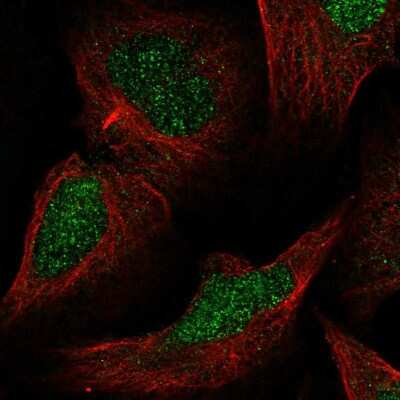 Immunocytochemistry/ Immunofluorescence: MLH3 Antibody [NBP2-55958]