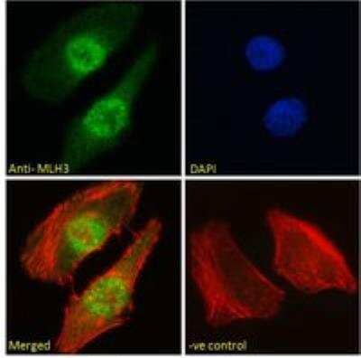 Immunocytochemistry/ Immunofluorescence: MLH3 Antibody [NBP2-78702]