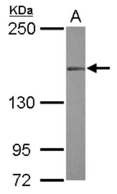 Western Blot: MLH3 Antibody [NBP2-17306]