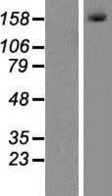 Western Blot: MLH3 Overexpression Lysate [NBP2-07349]