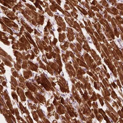 Immunohistochemistry-Paraffin: MLIP Antibody [NBP2-68608]