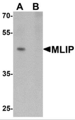 Western Blot: MLIP AntibodyBSA Free [NBP2-81738]