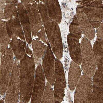 Immunohistochemistry-Paraffin: MLK2 Antibody [NBP1-87737]