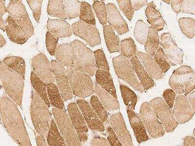 Immunohistochemistry-Paraffin: MLK2 Antibody [NBP3-06104]