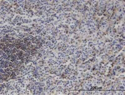 Immunohistochemistry-Paraffin: MLK3 Antibody (3D11) [H00004296-M02]