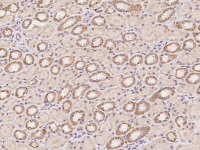 Immunohistochemistry: MLK3 Antibody [NBP3-06619]