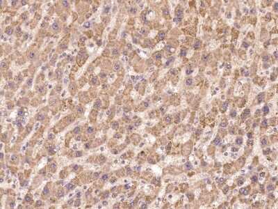 Immunohistochemistry: MLK3 Antibody [NBP3-06619]