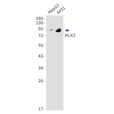 Western Blot: MLK3 Antibody (S07-2C3) [NBP3-19695]