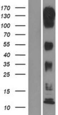 Western Blot: MLK3 Overexpression Lysate [NBP2-10830]