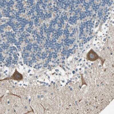 Immunohistochemistry-Paraffin: MLK4 Antibody [NBP1-90950]