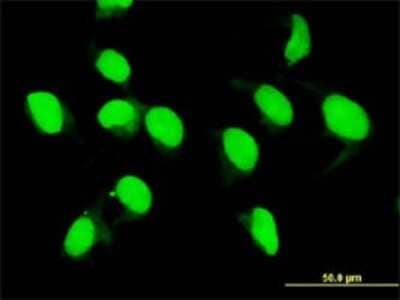 Immunocytochemistry/ Immunofluorescence: MLKL Antibody (3B2) [H00197259-M02]