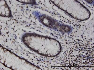 Immunohistochemistry-Paraffin: MLKL Antibody (3B2) [H00197259-M02]