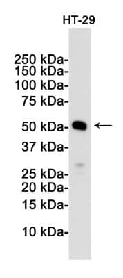 Western Blot: MLKL Antibody (S07-5G9) [NBP3-14899]