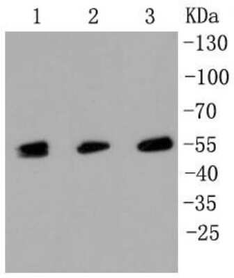 Western Blot: MLKL Antibody (SA40-04) [NBP2-67299]