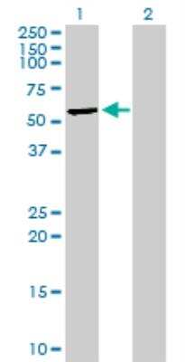 Western Blot: MLKL Antibody [H00197259-B01P]