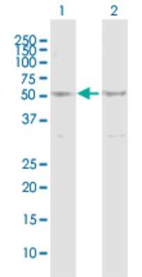 Western Blot: MLKL Antibody [H00197259-B01P]