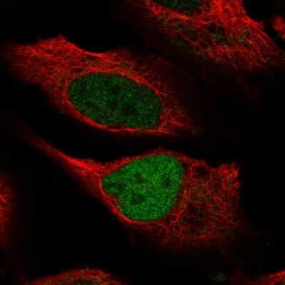 Immunocytochemistry/ Immunofluorescence: MLL3 Antibody [NBP2-57730]