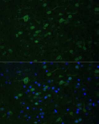 Immunohistochemistry: MLL5 Antibody - Azide and BSA Free [NBP3-03559]